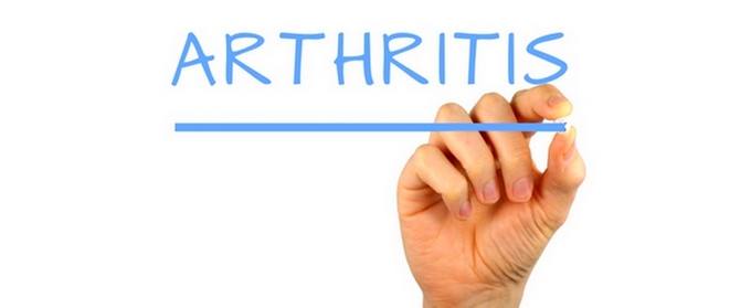 Arthritis Natural Remedies